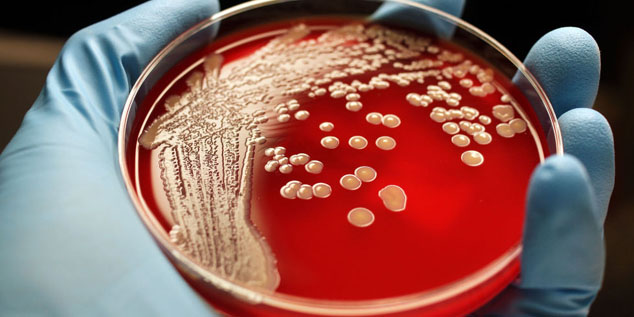 mrsa staph infections