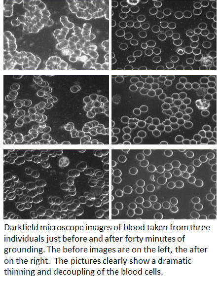 earthing vs blood viscosity