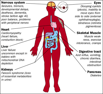 mitochondrial-based disorders