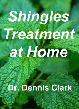 shingles treatment at home - cover 2
