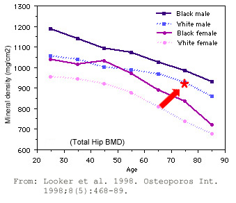 bone mineral density age ranges with labels